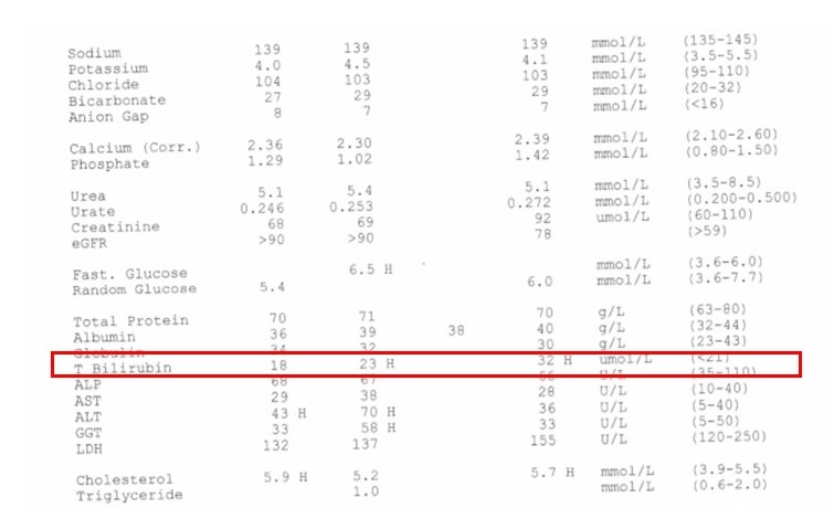 gilberts disease bilirubin bloods example at true foods nutrition online nutritionist