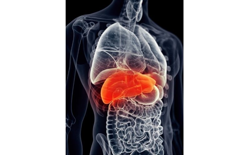 gilbert's syndrome causes elevated bilirubin as you can see in blood test results from true foods nutrition in sydney