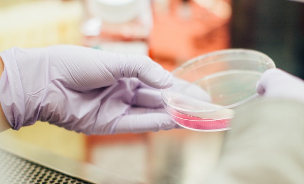 Bacterial overgrowth Sydney Nutritionist